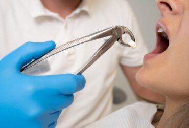 drfaridnikfar-services-surgical-extractions