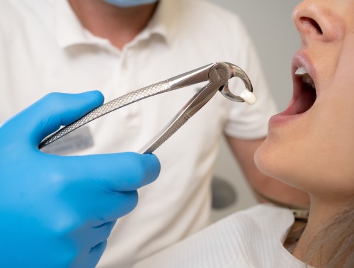 drfaridnikfar-services-surgical-extractions