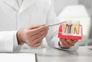 drfaridnikfar-services-dental-implant